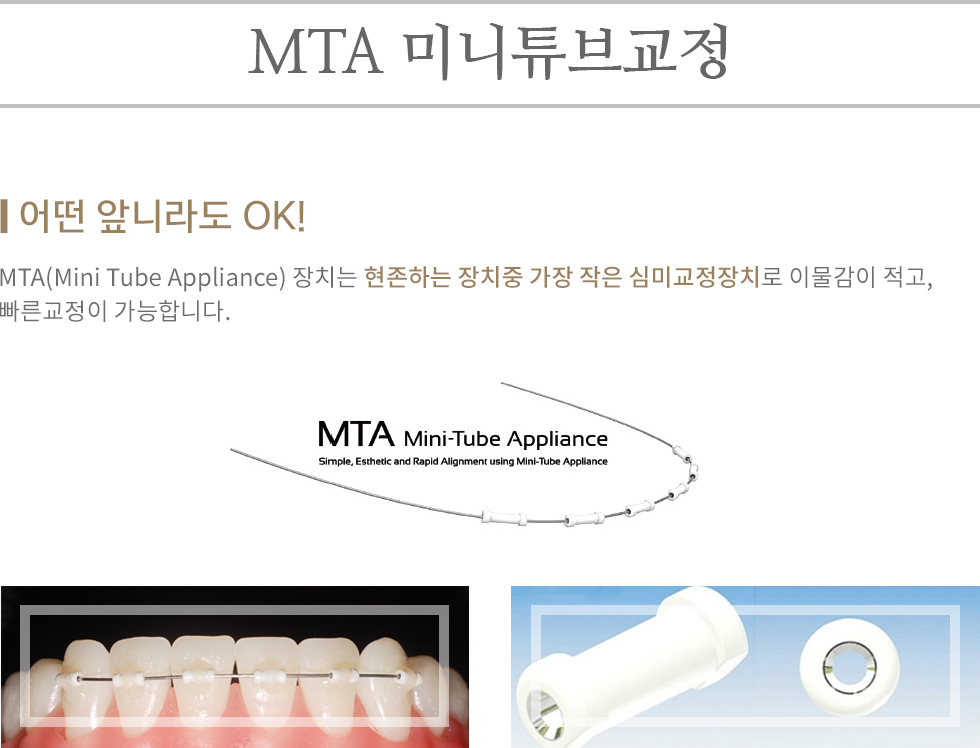 MTA 미니튜브교정