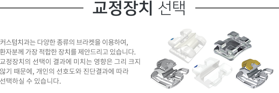 교정장치선택