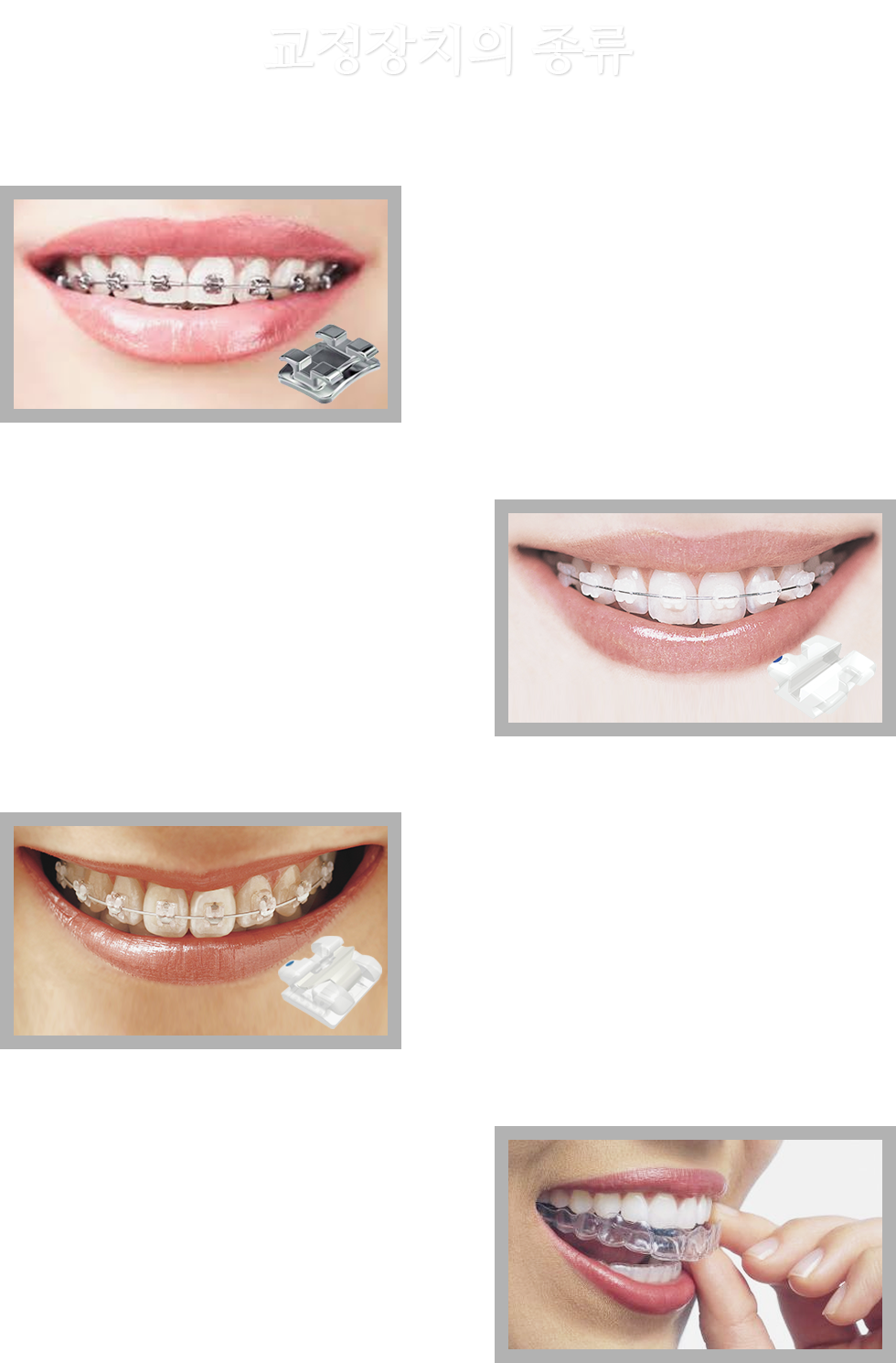 교정장치의 종류